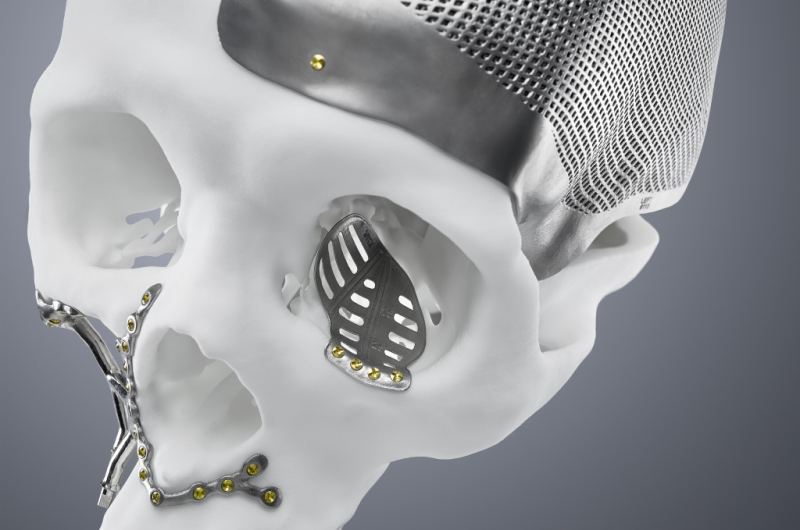 Ridix e Trumpf: connubio vincente nella stampa 3D